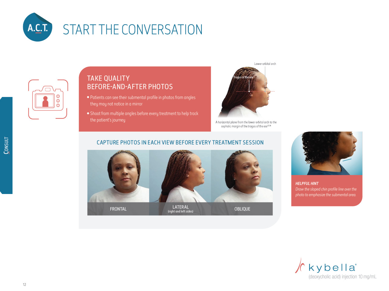 consult about kybella